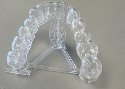 LuxCreo clear aligner print