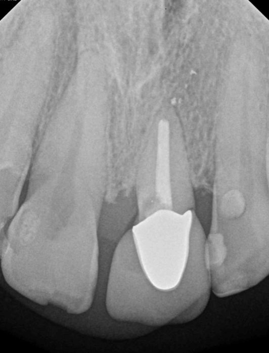 Pre op x-ray