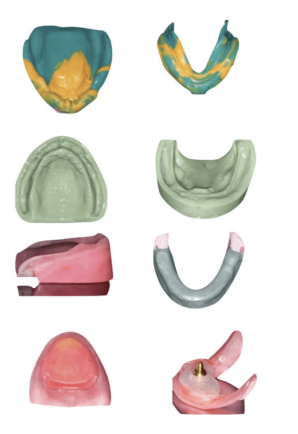 Denture Course Image