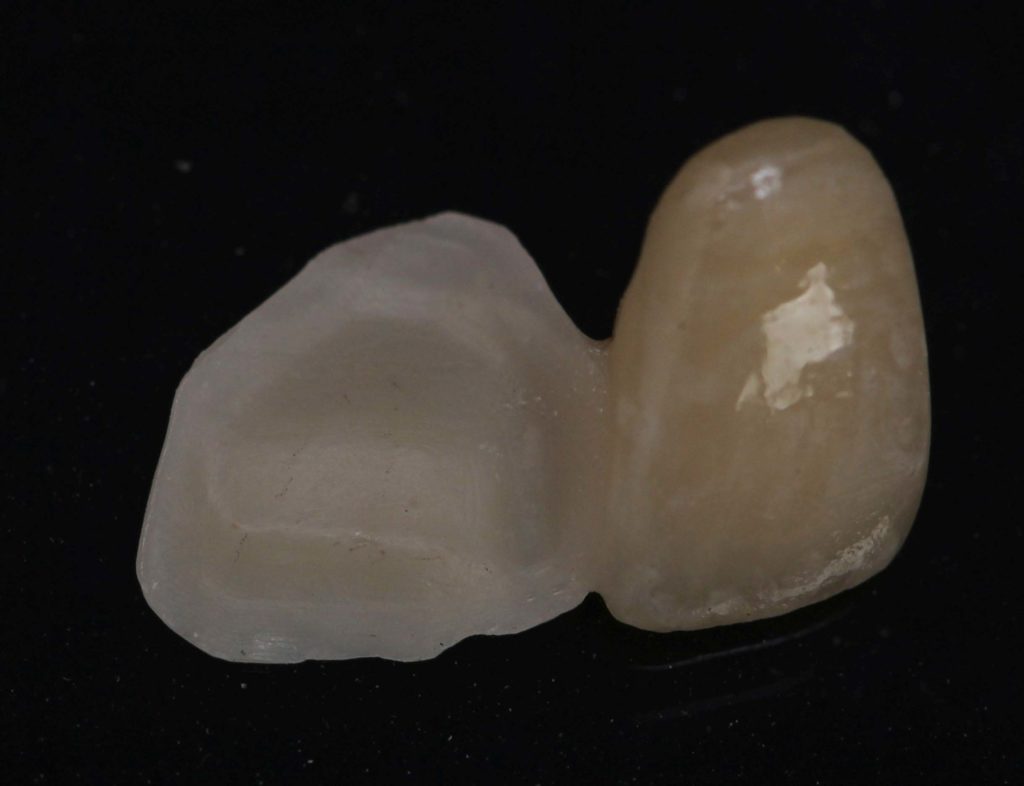 Periodontal Restoration Course