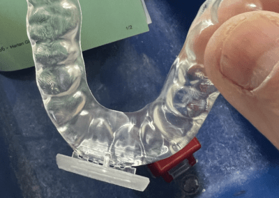 luxcreo clear aligner print